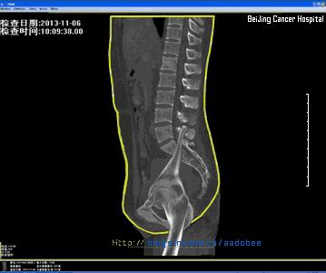 尾闾中正及尾闾正中的区别,尾闾中正啥意思