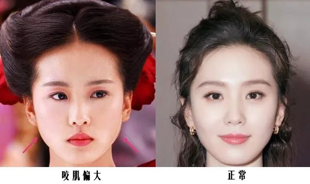 脸型不对称的女孩咋办,脸型不好看怎么整容