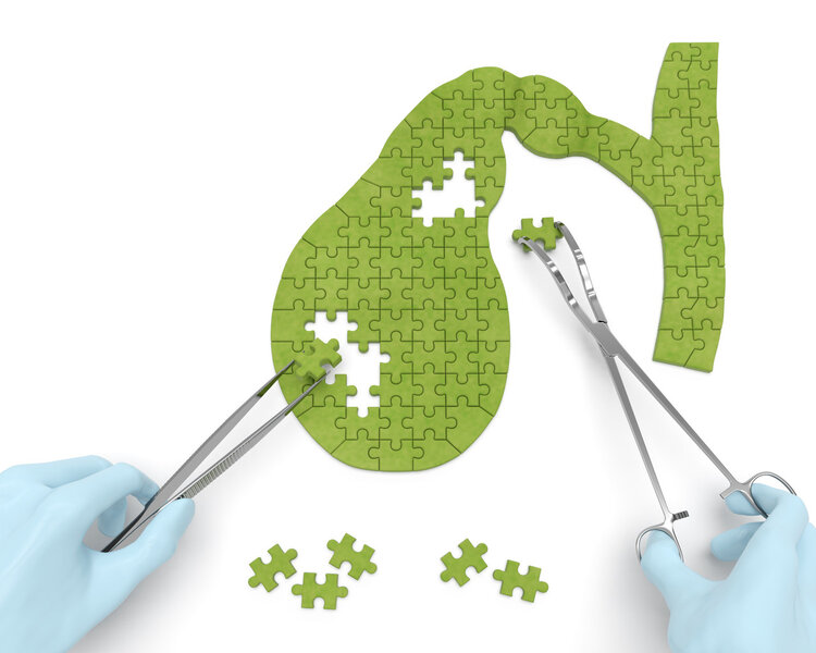 核桃是血管清道夫,核桃是血管的清道夫