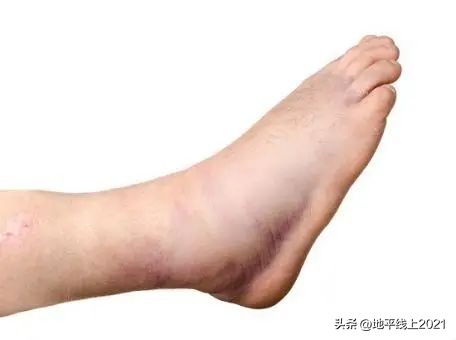 小孩被自行车撞康复要赔偿,孩子不小心被自行车撞了一下