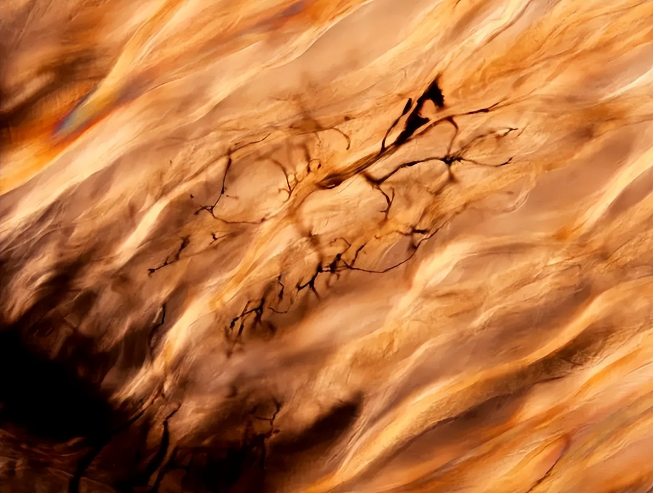 牙齿为何如此坚硬呢,火化后为什么牙齿不见了