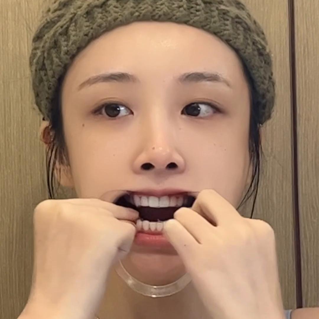 笑起来好看的牙齿,佳洁士什么牙膏能美白牙齿