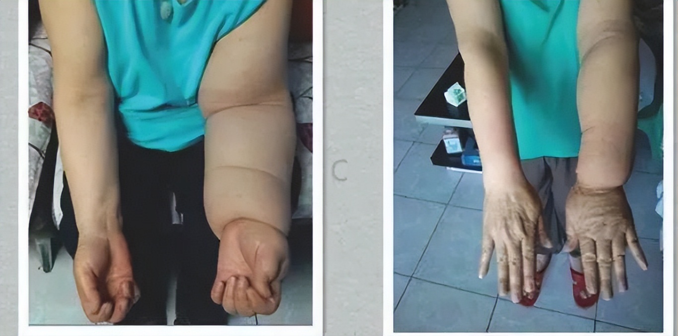 发现寄生虫要报警吗,报警后为什么知道我的详细地址