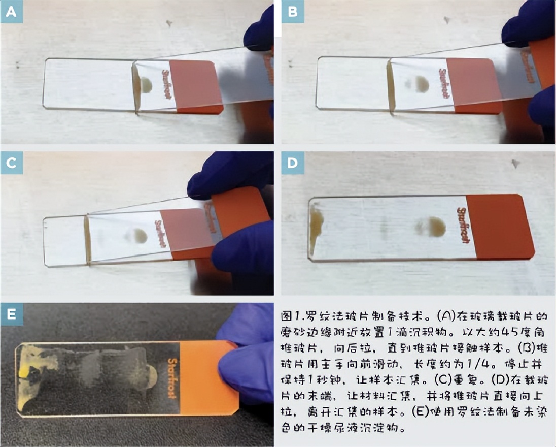 尿液干化学分析的实验原理,尿液标本采集操作