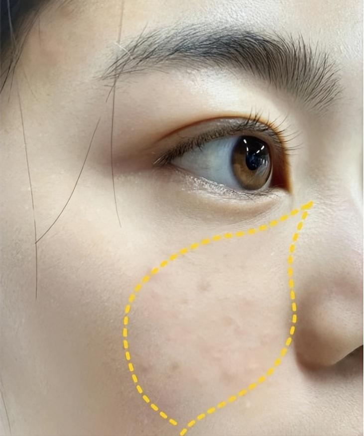 口碑好的抗衰老护肤品,口碑最好的抗衰老护肤品有哪些