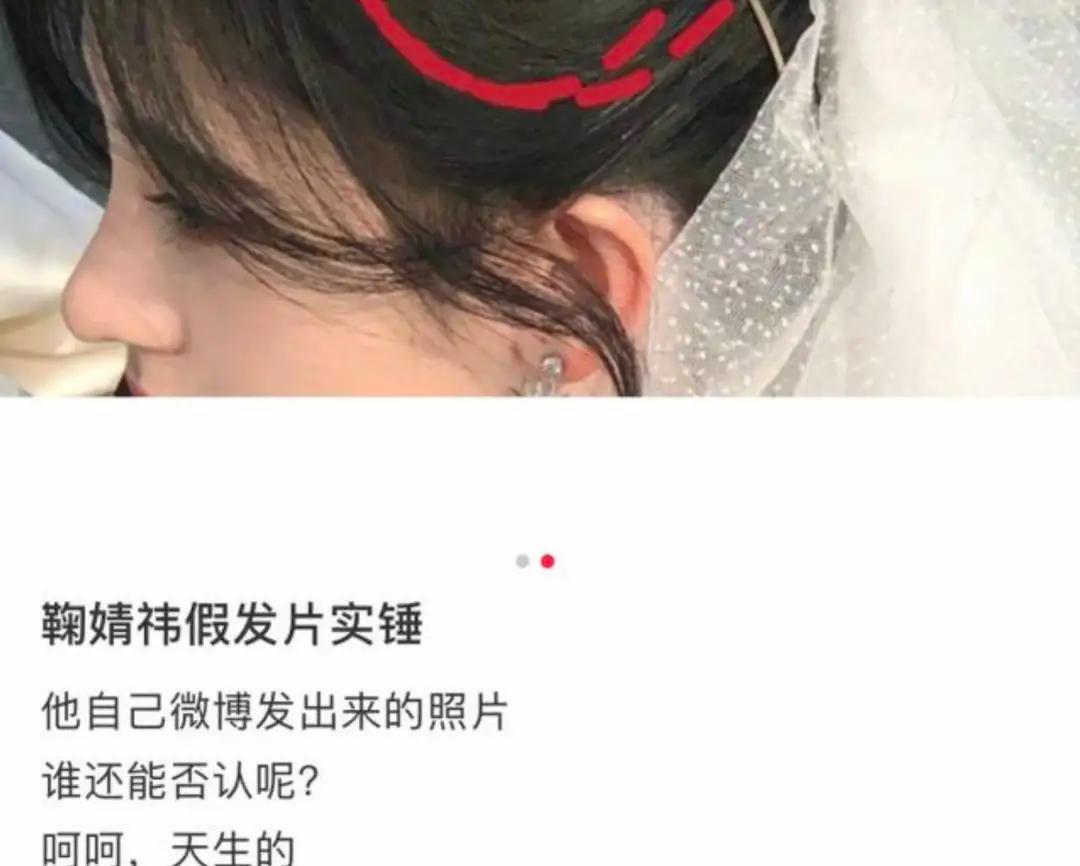 心机女孩鞠婧祎：被潘玮柏刁难拒绝王思聪求爱，整容遭贾玲内涵