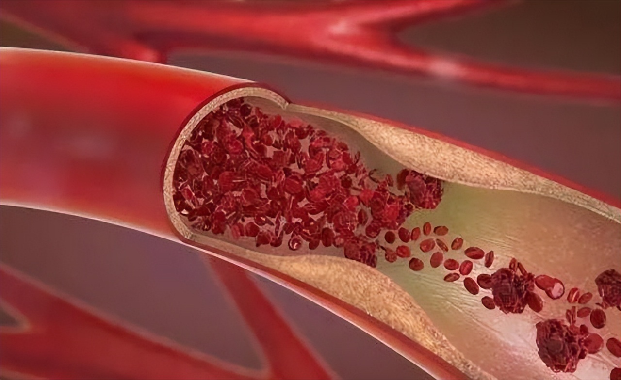 去献血对血液排毒有好处吗,定期献血有什么好处和坏处