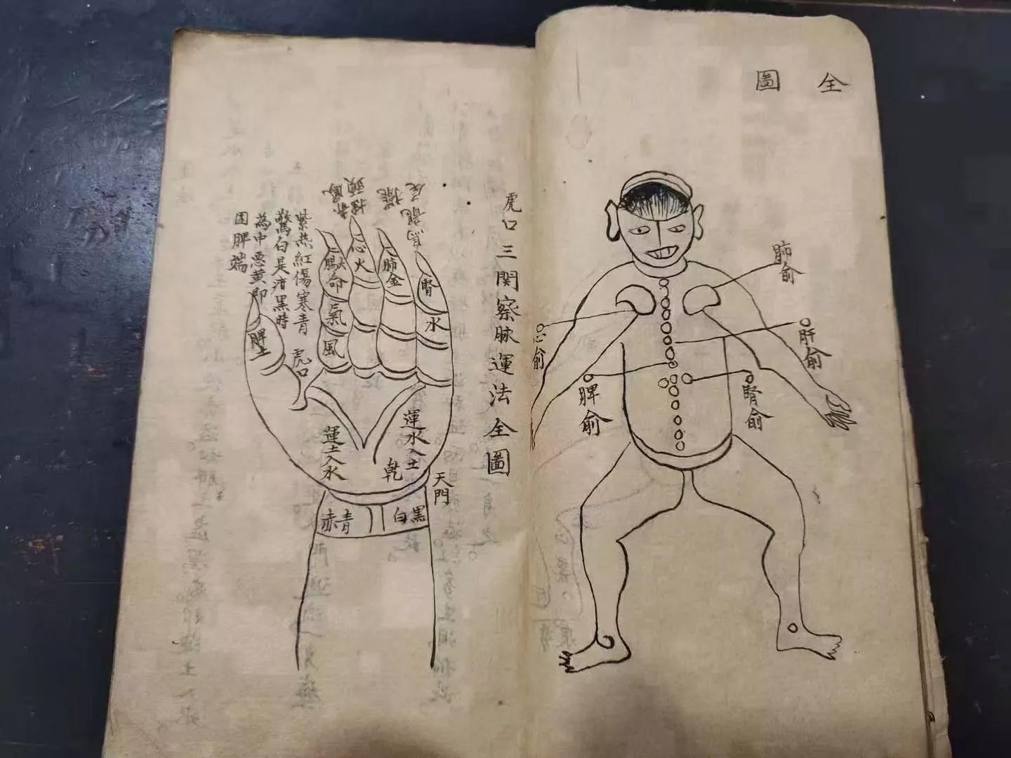 火灸疗法的书,藏医火灸疗法书