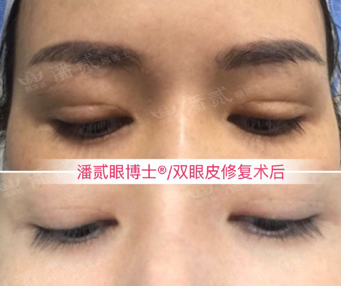 美容手术不想做了会退钱吗,美容整形不花钱