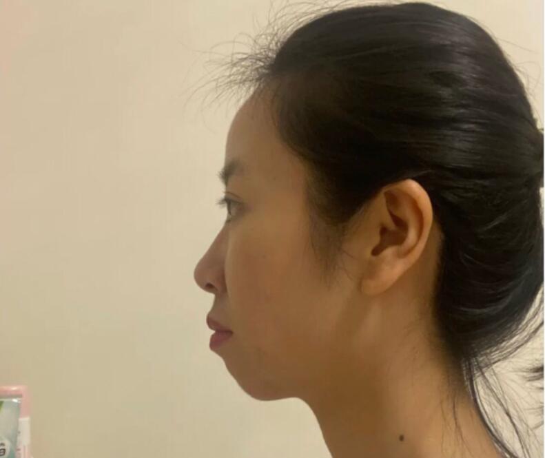 同样都是“凸嘴”，为什么有人风情万种，有人一股土味？答案在这