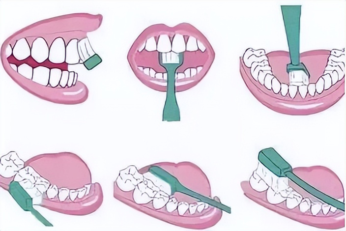 儿童用电动牙刷的好处与坏处,电动牙刷刷牙的好处和坏处