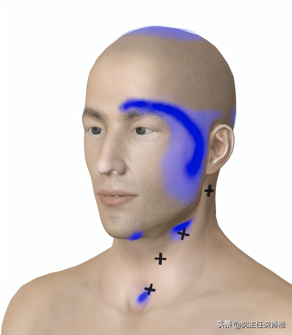 太阳穴疼痛警惕四种病,太阳穴周围疼痛是什么病的预兆