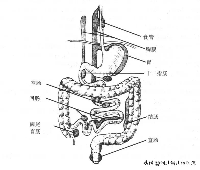 胎儿消化道畸形可以存活吗,新生儿消化道畸形能治好吗