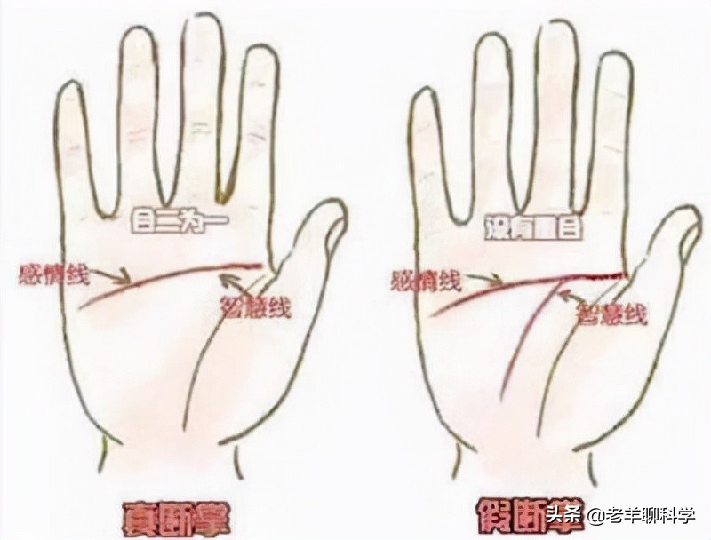 断掌纹有科学依据吗,男子一只手纹断掌好吗