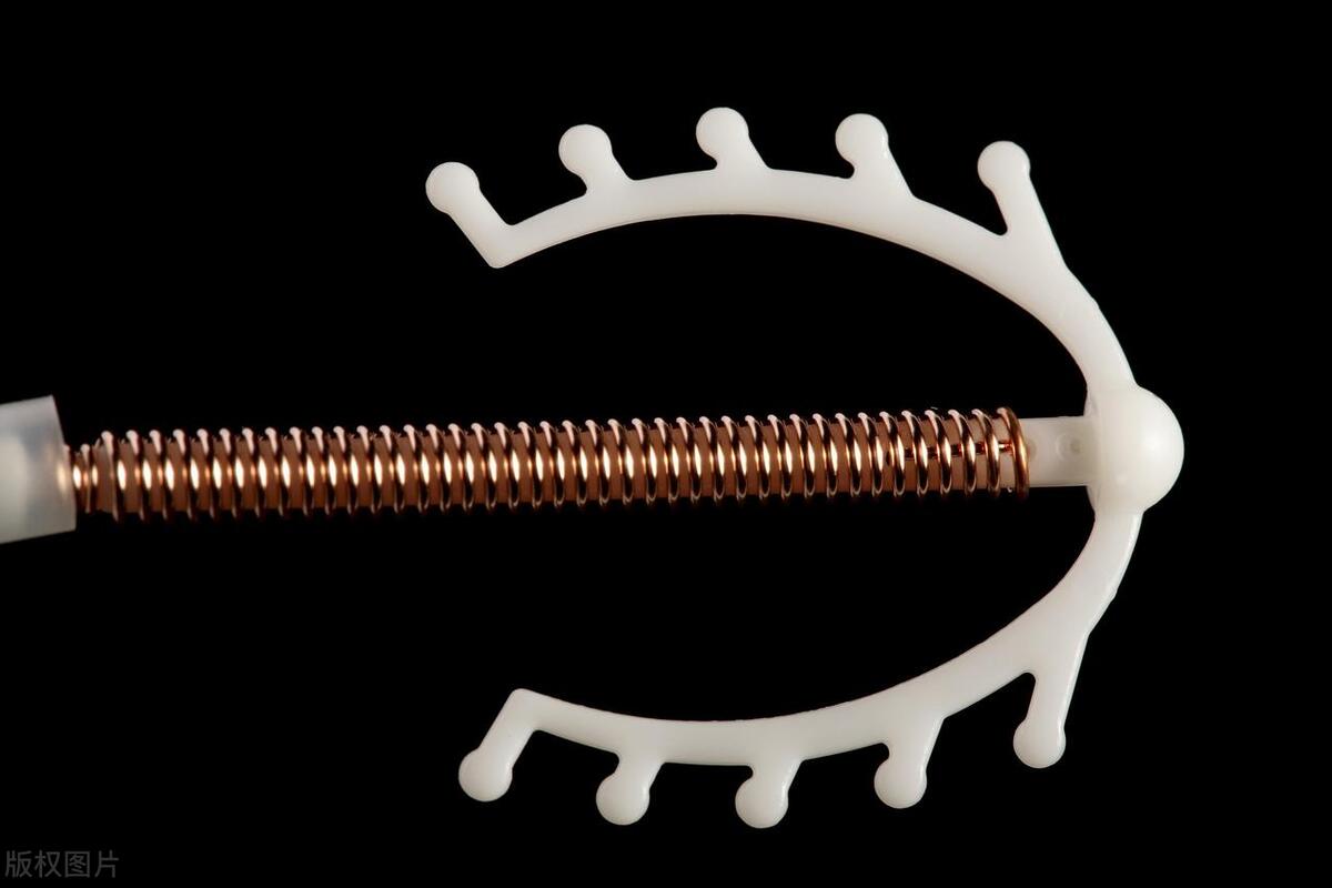 女性上环的种类和形状,女性上环的全部过程是什么