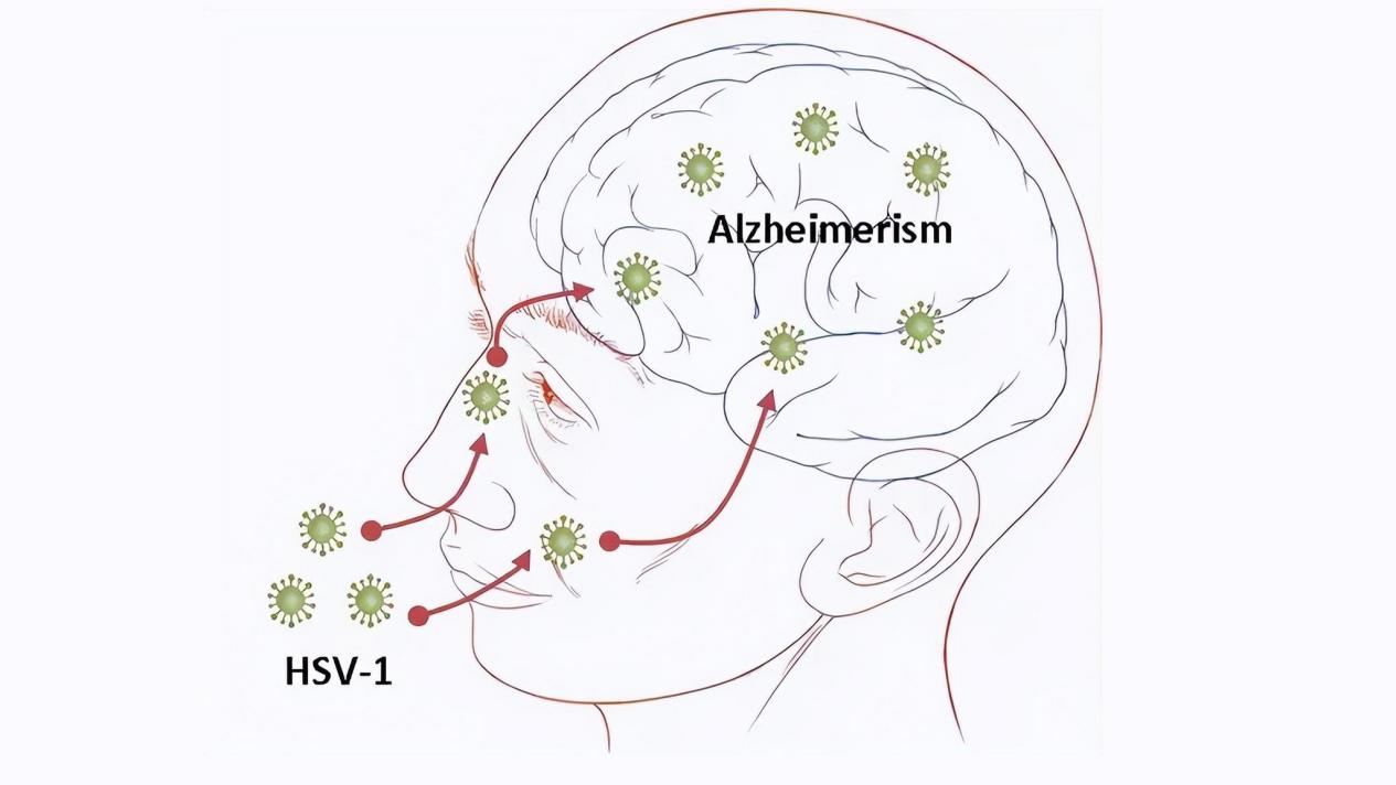 怎么知道自己上火了都有哪些症状,以为是上火其实是癌症