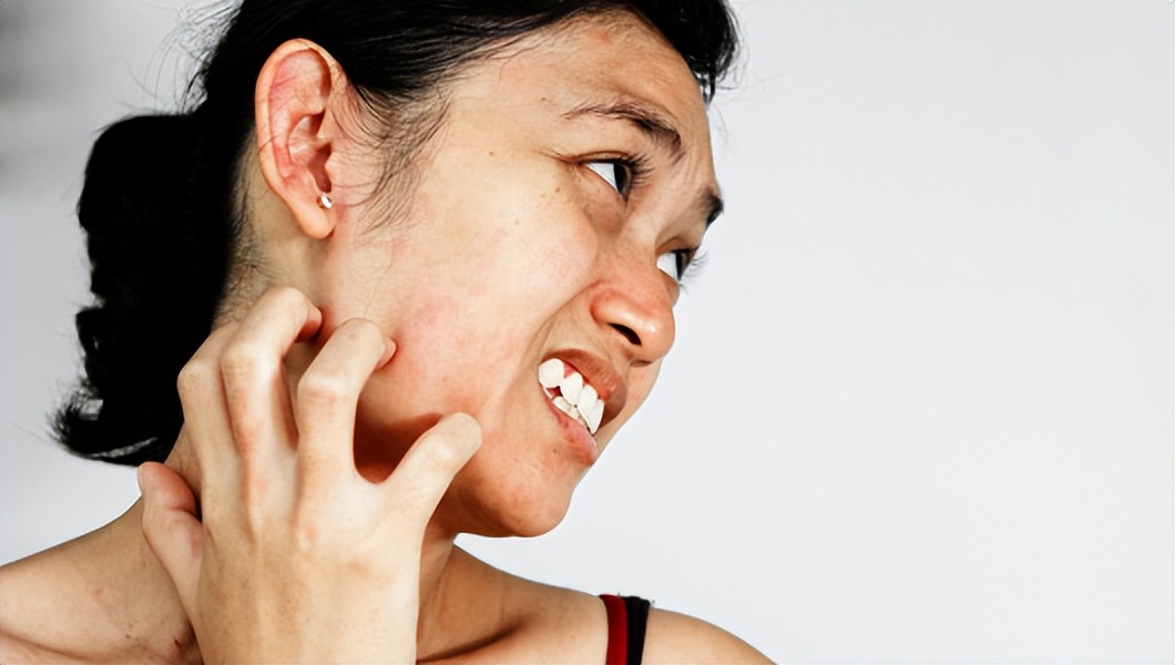 什么食物属于发物,什么是发物食物对身体有什么危害