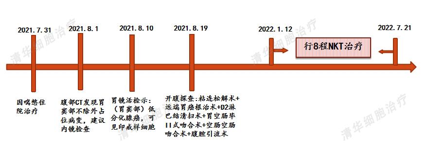83岁高龄患印戒细胞癌，是细胞治疗让他多一个治疗手段