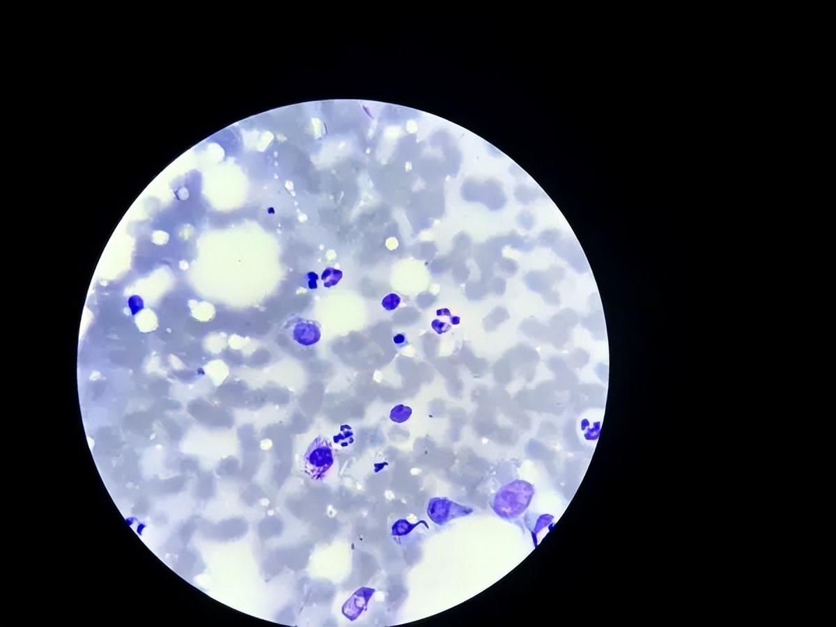 中医认为肛门瘙痒症的发病原因是什么？有何治疗建议？