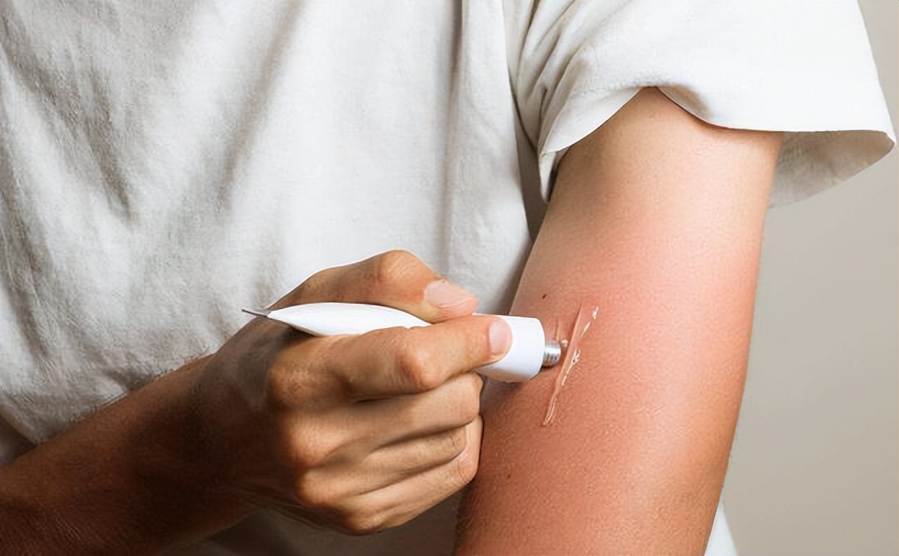 淡斑祛斑小妙招红霉素软膏,两块钱的红霉素软膏淡斑