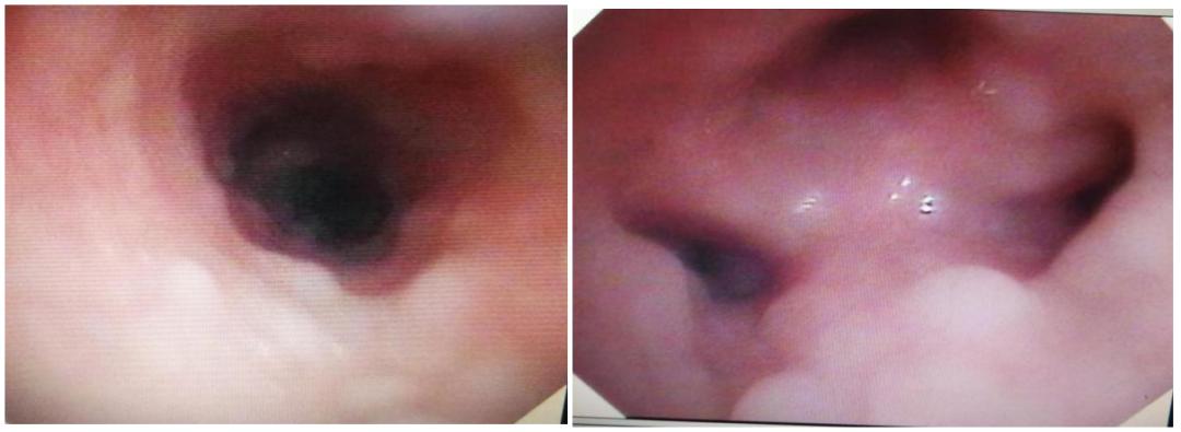 徐州市儿童医院呼吸二科,儿童呼吸介入科的设备