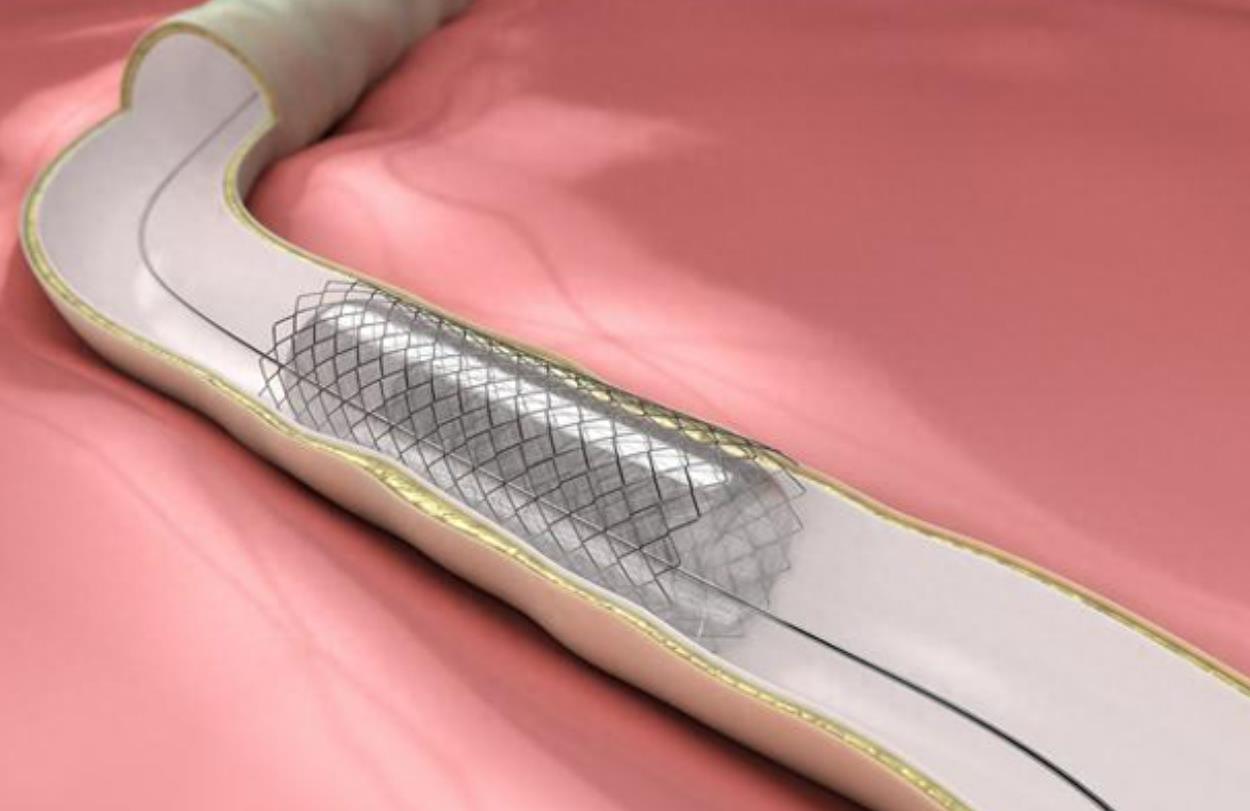 使用近红外荧光成像，进行生物功能性可降解支架的无创监测工程