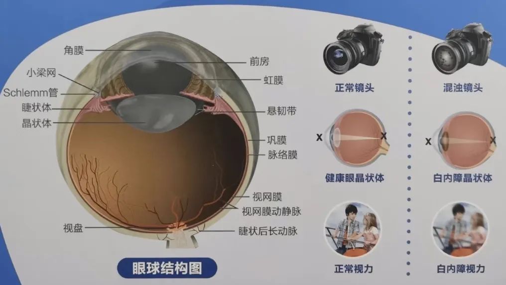 吃什么缓解眼干眼涩眼疲劳,眼干眼涩无神怎么调理最好