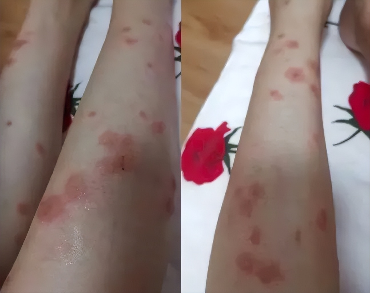 去公园可怕的虫子,去公园如何避免蚊虫叮咬