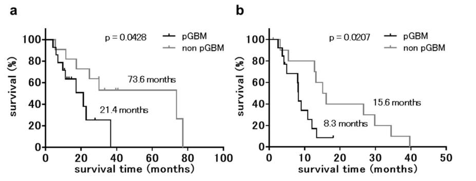 硼中子俘获疗法（BNCT）联合贝伐珠单抗治疗复发恶性胶质瘤