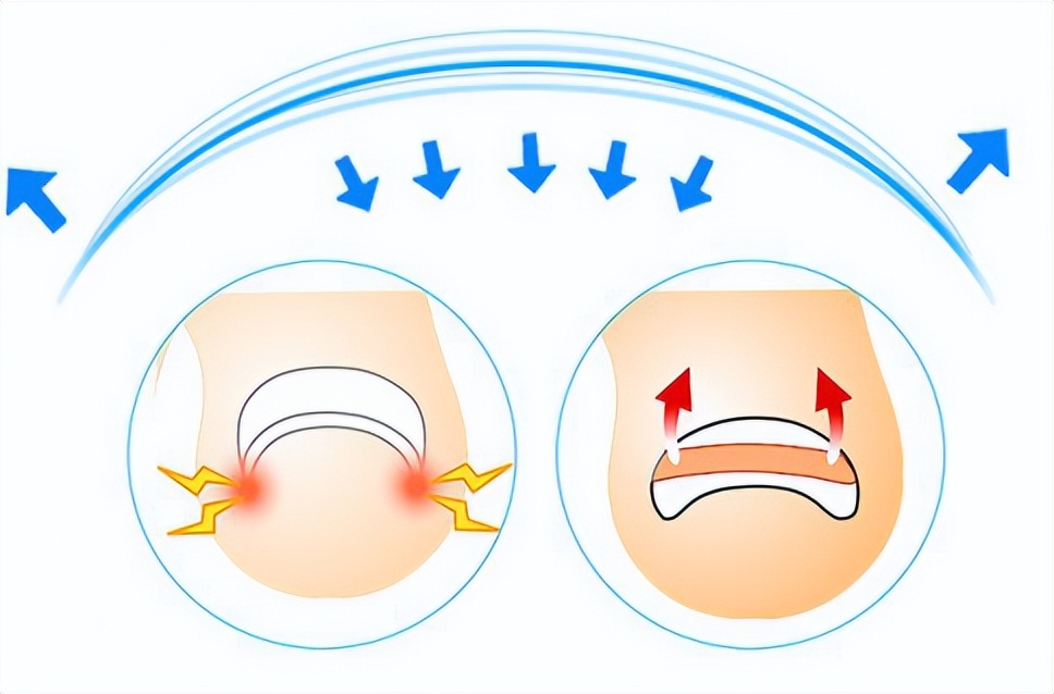 一走路脚趾甲里疼怎么回事,甲沟炎拔完脚趾甲很疼怎么办