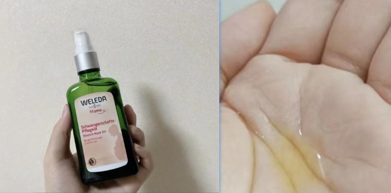 消除妊娠纹是不是智商税,妊娠纹产品是智商税吗