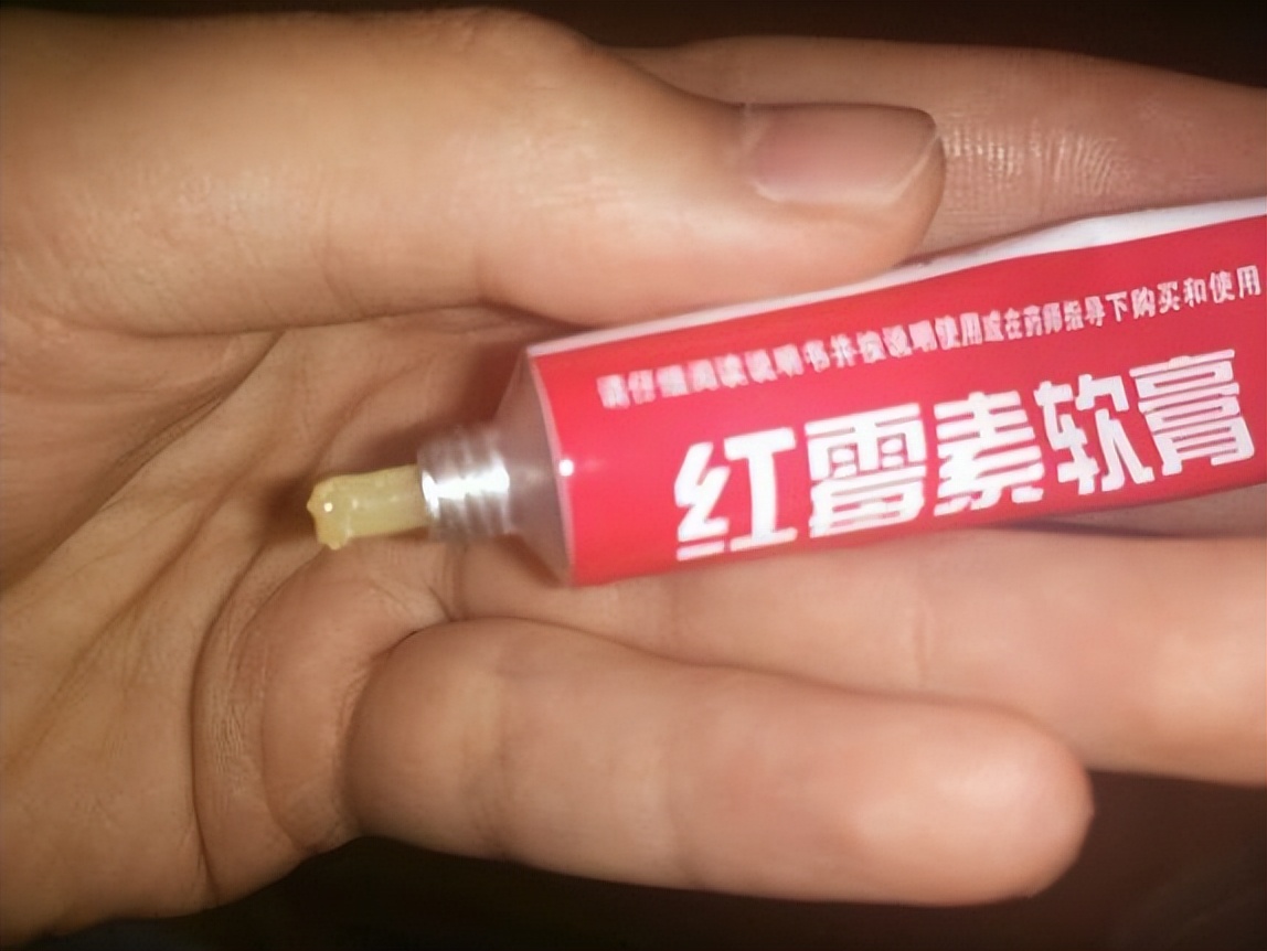 红霉素软膏都能治什么,红霉素和金霉素软膏的作用和功效