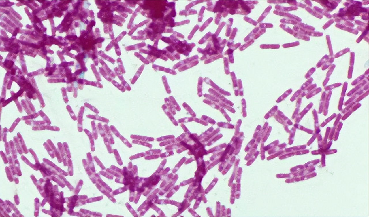 阿莫西林要认清只对这4种病有效,阿莫西林别乱用6种病能用