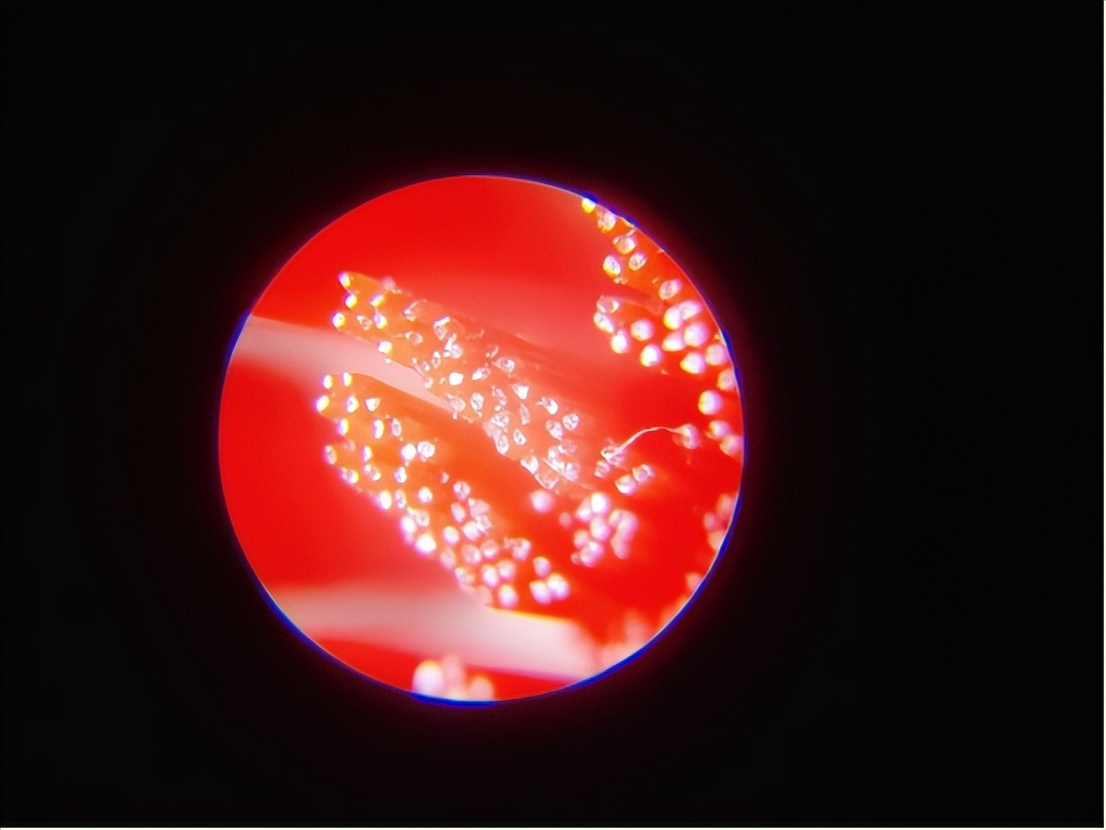 飞利浦usmile电动牙刷测评,电动牙刷推荐欧乐b