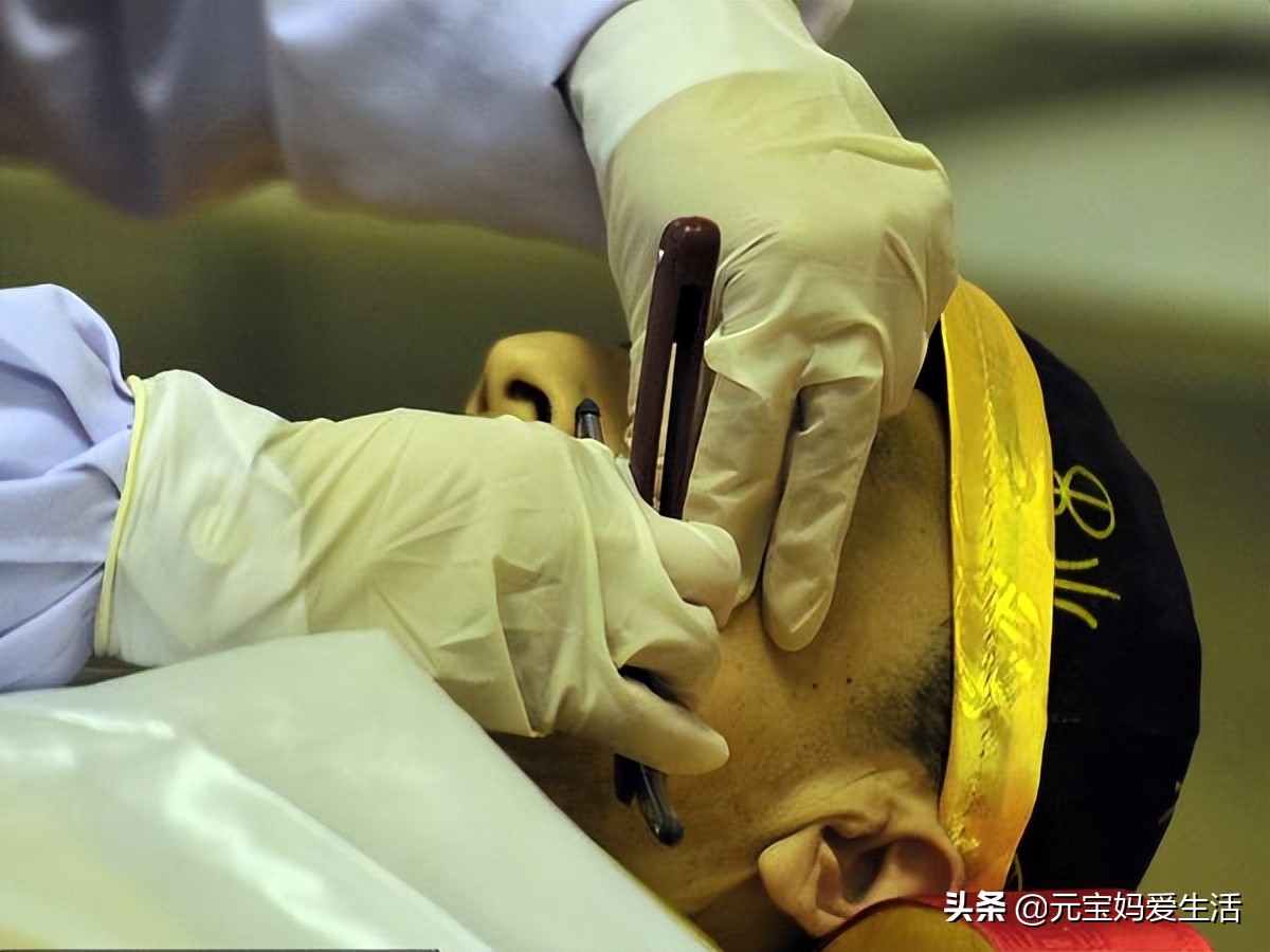 人死后到殡仪馆需要封肛吗,为什么在医院去世要堵住鼻孔