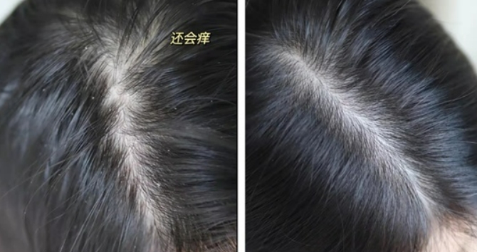 年轻人用哪款蜂花洗发水,蜂花洗发水国货第一名