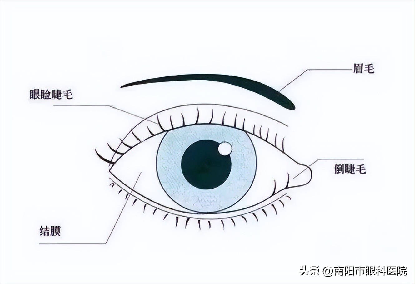 眼睛下睑内翻该咋治疗,眼睛轻微睑内翻