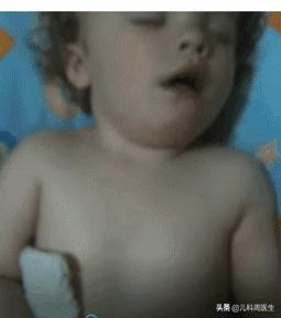 小儿支原体肺炎怎么能彻底治疗,小儿支原体肺炎怎么治疗最好