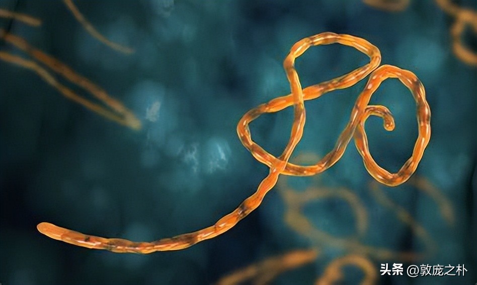 地球上最致命的四种病毒,地球史上最可怕的十种病毒