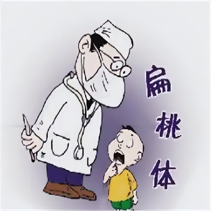 扁桃体发炎和扁桃体脓肿哪个严重,如何有效缓解扁桃体发炎