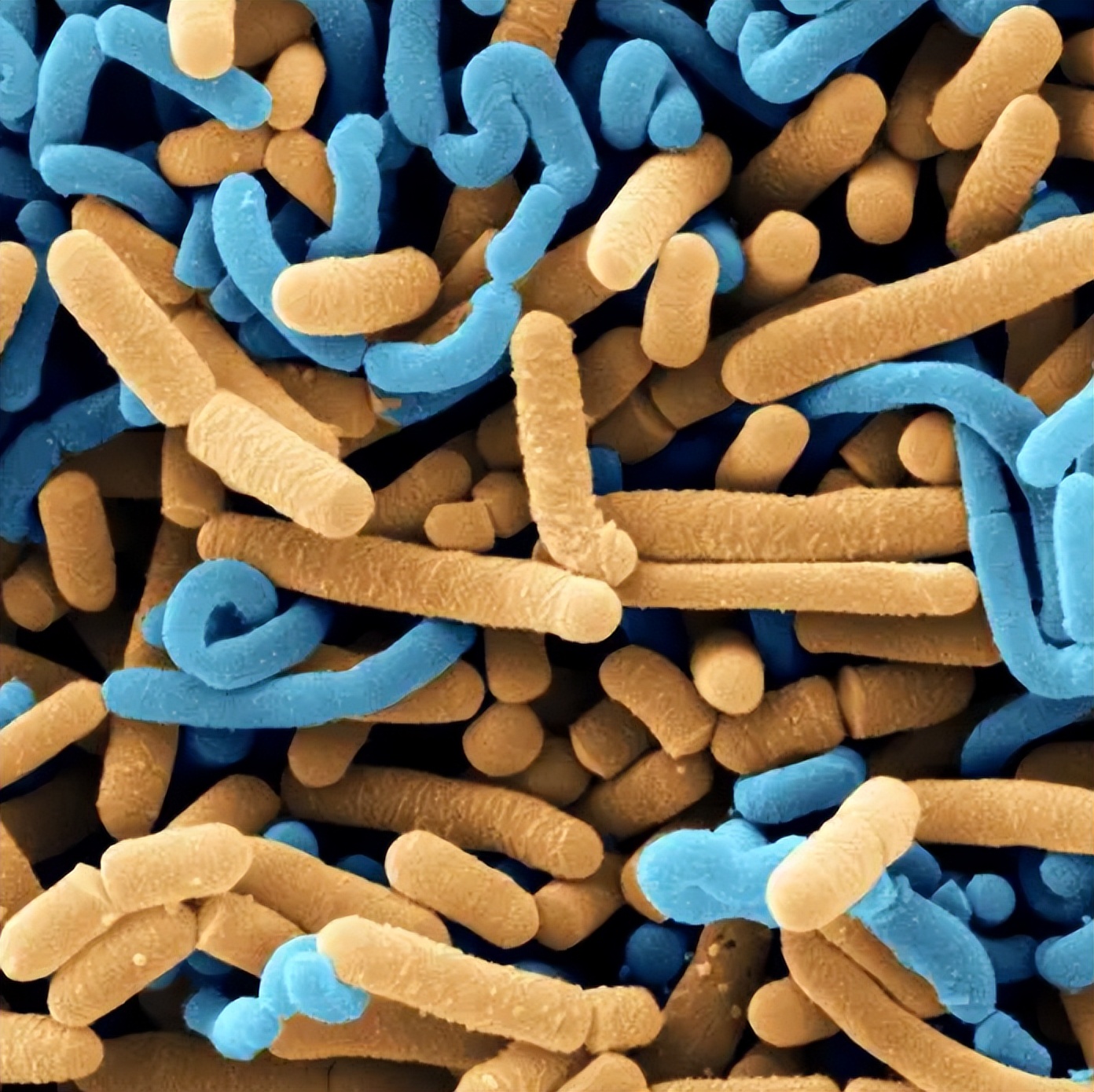 不起眼的五个行为正在毁掉你的肾,6个不起眼的习惯正在伤害眼睛