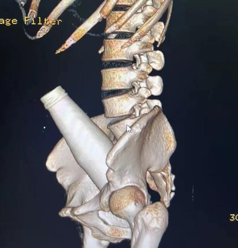 「医界趣闻」肛肠科那些事儿