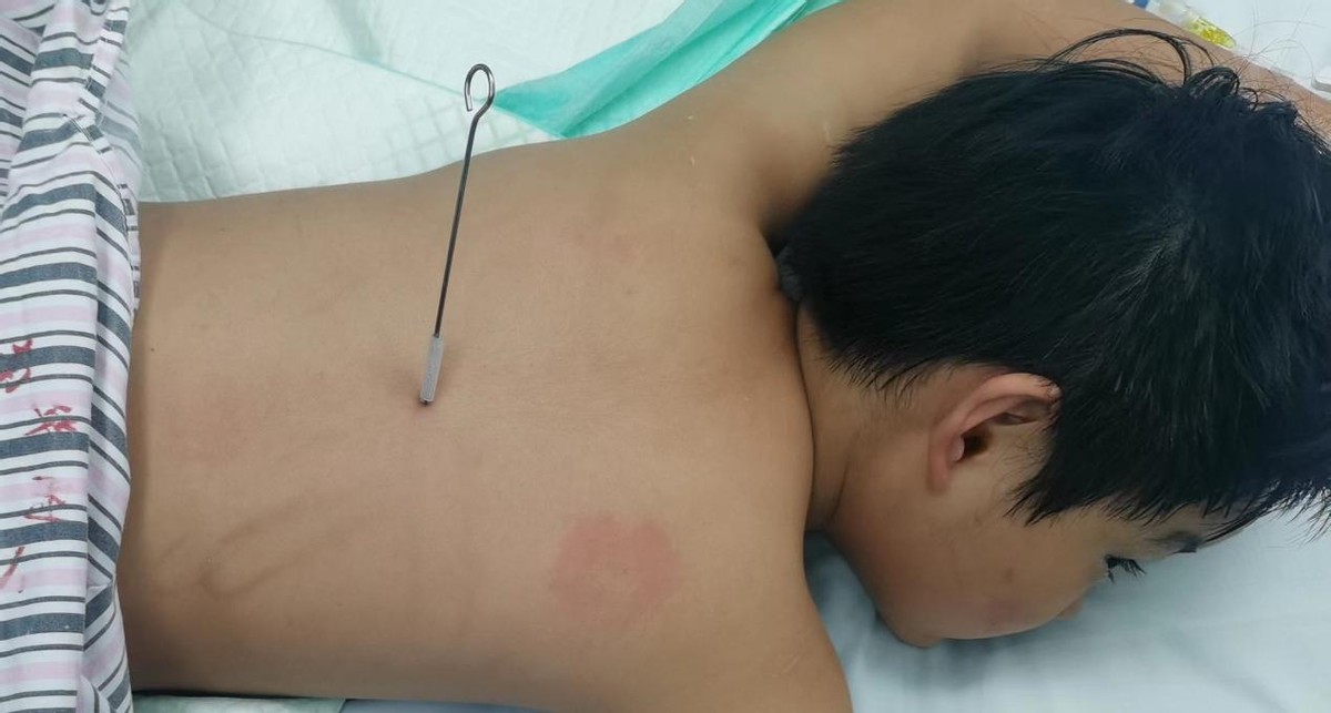 閽㈤拡鍒虹┛鑳歌啗,閽㈤拡鍒虹┛杞缁勭粐