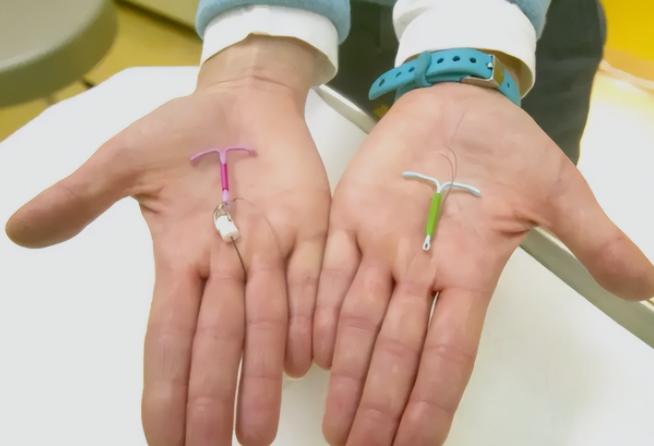 节育环在女性体内,会发生哪些变化?30年前上环的女性有哪些结局