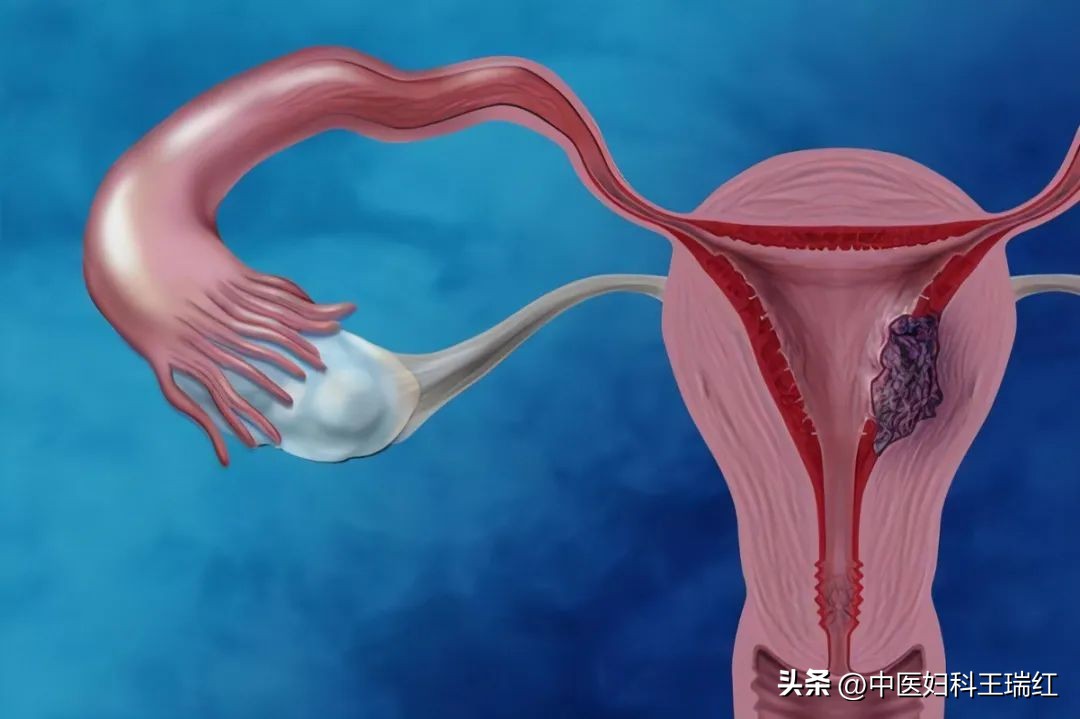 记住这十条让你远离妇科病,想要远离妇科病你得先做好这一步