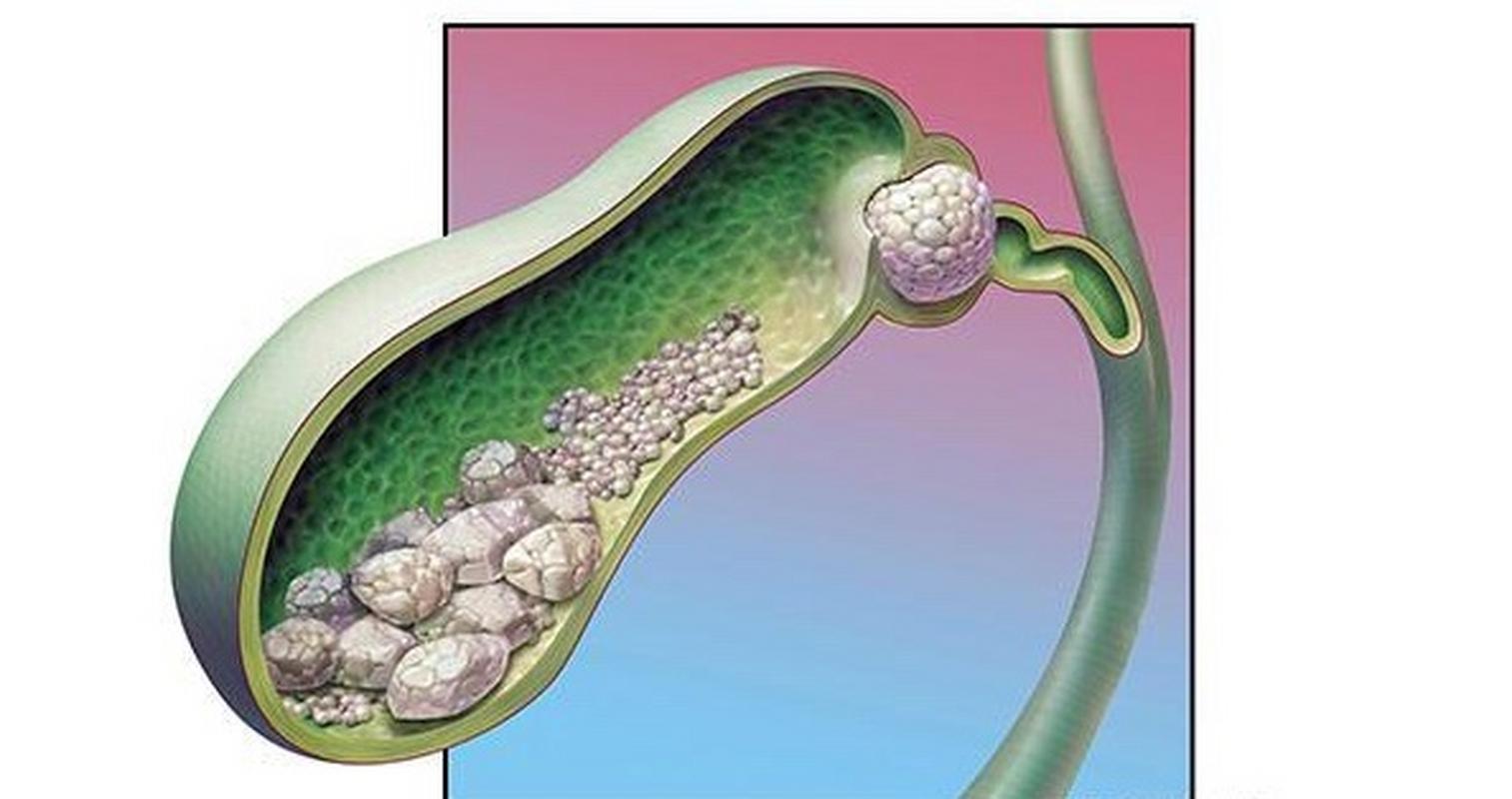 核桃是血管天然清道夫,核桃是生吃去瘀血还是熟吃的有效