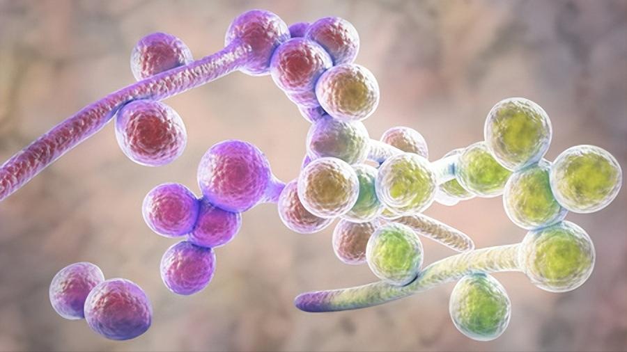 霉菌性阴道炎，是怎么回事儿？多半是这3个原因，你中招了吗