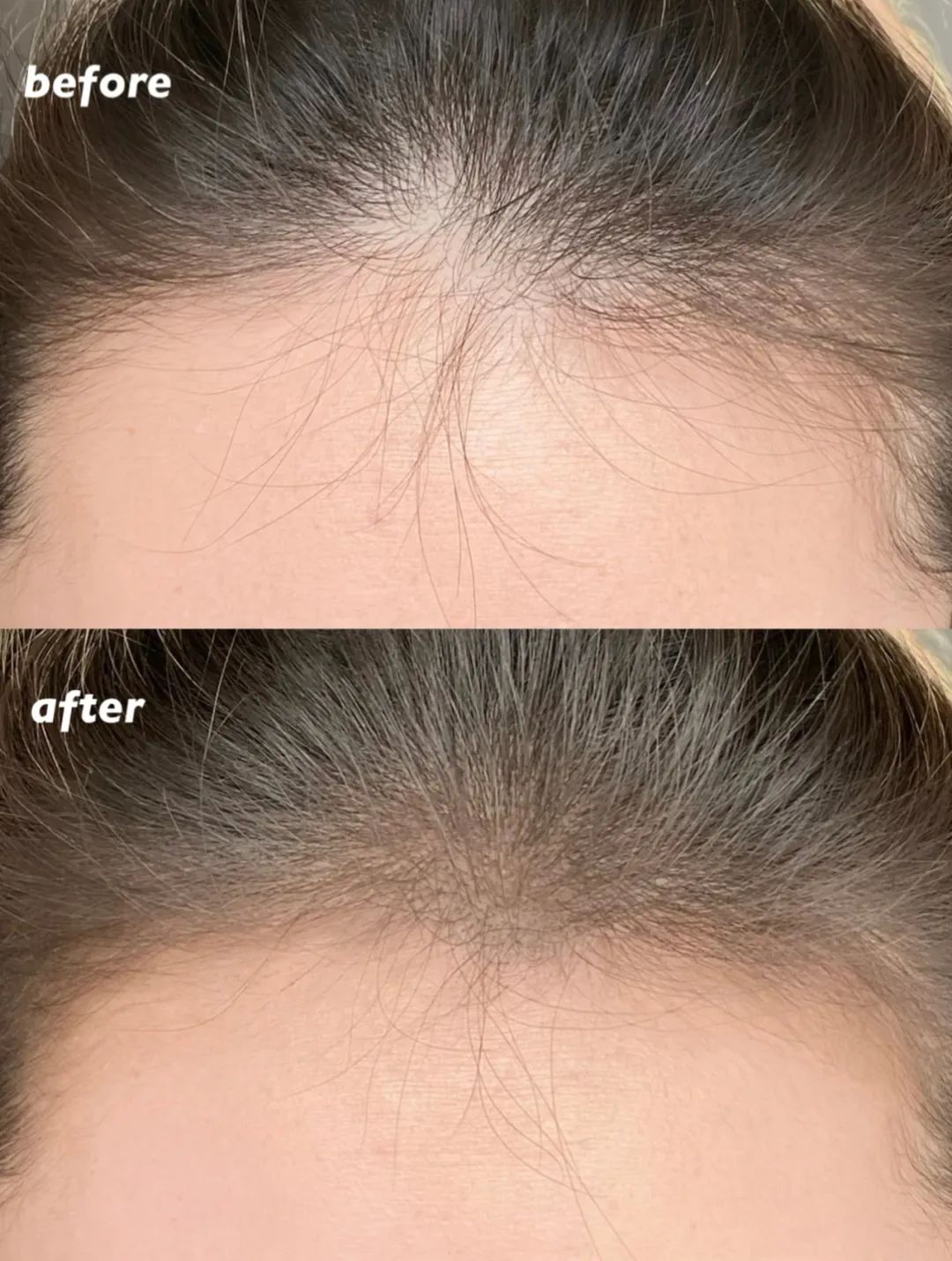 发量少适合哪款卷发,自然卷发适合烫什么样的卷发