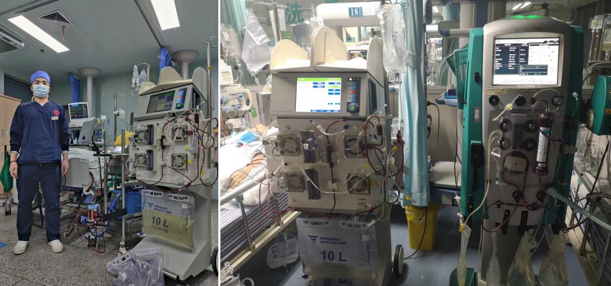 血液净化治疗新冠肺炎效果,连续性血液净化crrt操作视频
