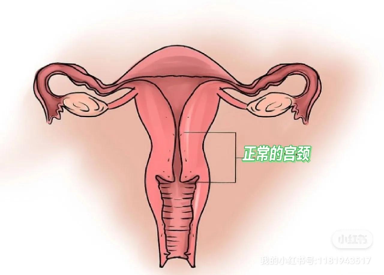 女神节特辑之什么是宫颈机能不全